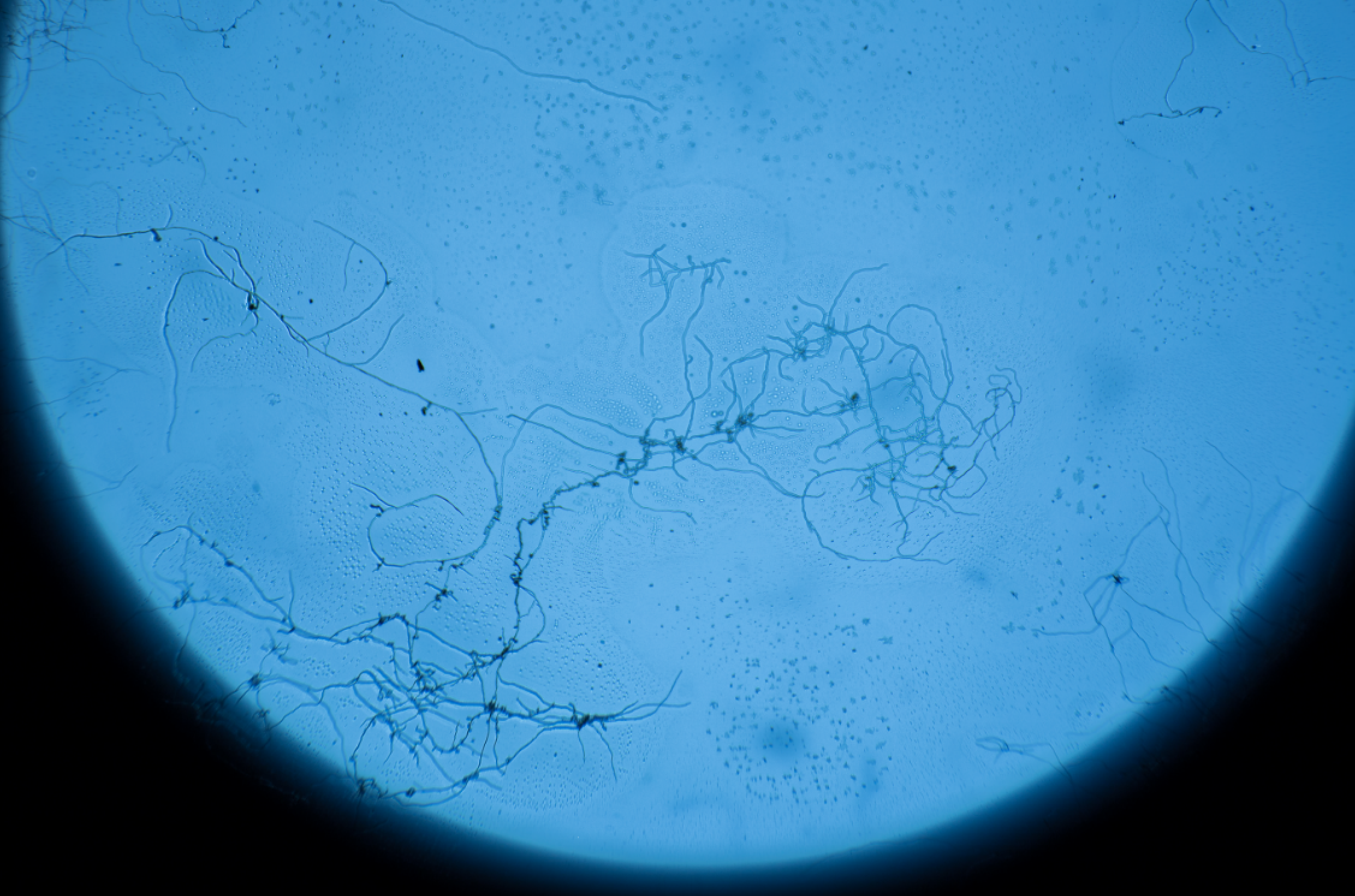 The Choice for Mold & Fungus Prevention